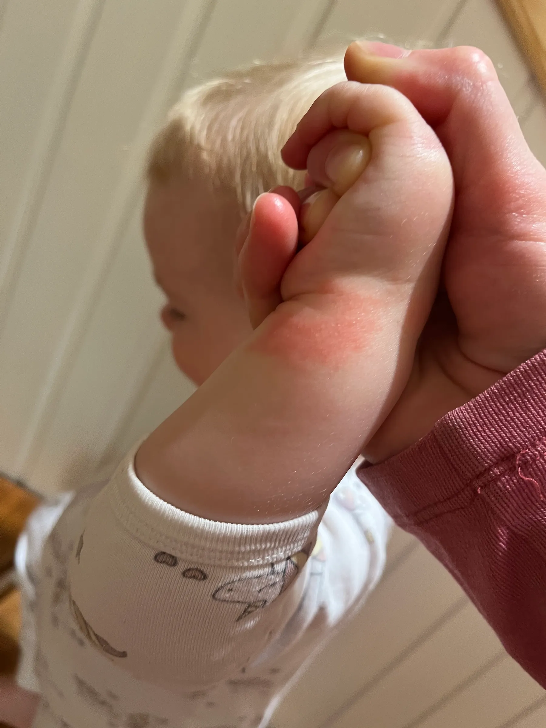 A toddler's wrist with a mild red patch of eczema, held gently in an adult's hand